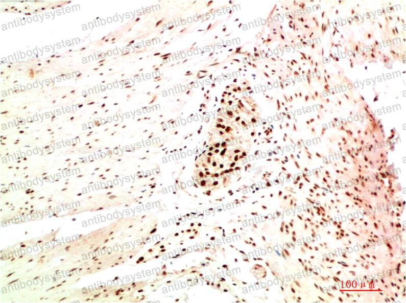 Anti-CBX5 Antibody (R3L37)