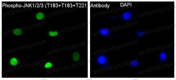 Anti-Phospho-JNK1/2/3 (T183 + T183 + T221) Antibody (R1C42)