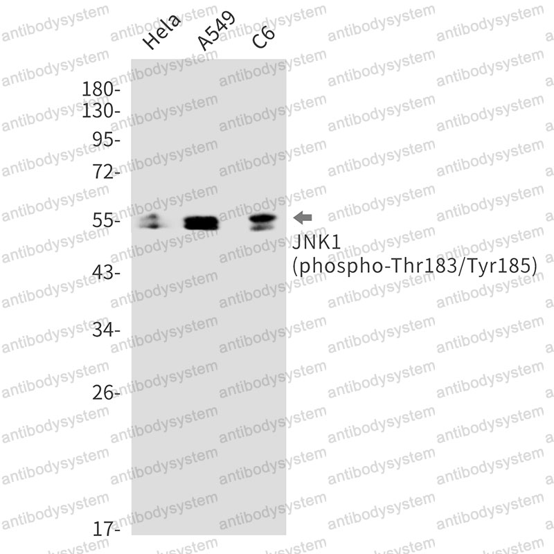 Anti-Phospho-MAPK8/JNK1 (Thr183/Tyr185) Antibody (R1W66)