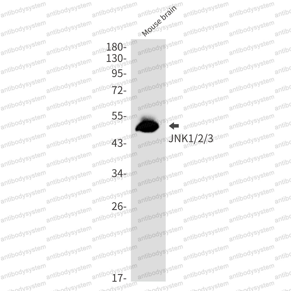 Anti-MAPK8 Antibody (R1W69)