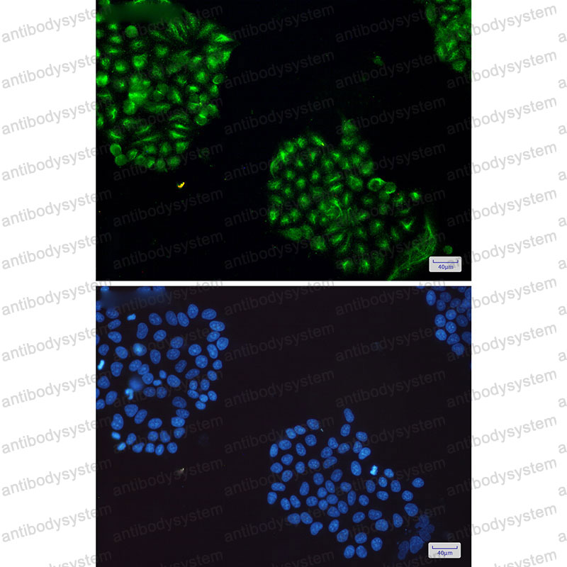 Anti-MAPK8 Antibody (R1W70)