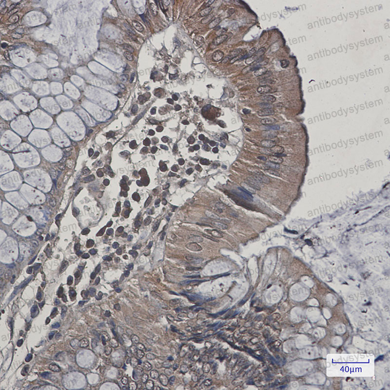 Anti-MAPK9 Antibody (R1W71)