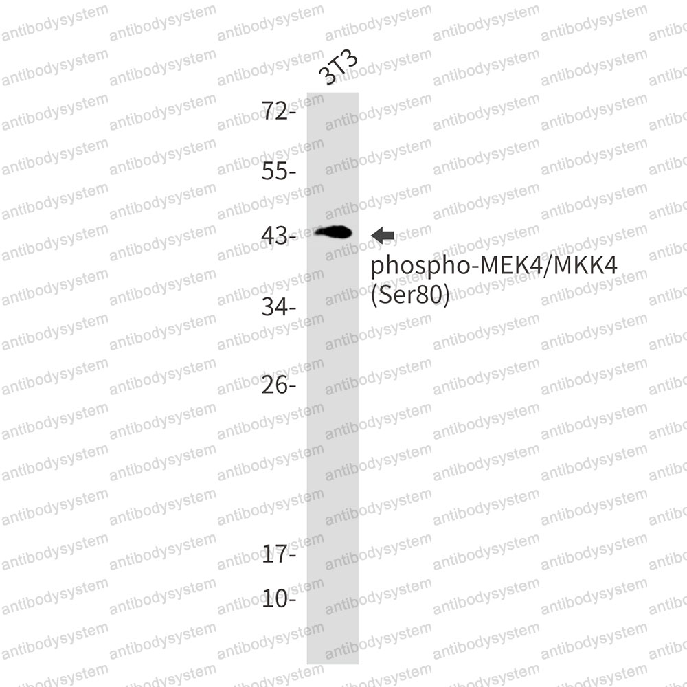 Anti-Phospho-MAP2K4/MEK4 (Ser80) Antibody (R1W72)