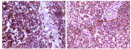 Anti-MAP2K4 Antibody (R3L41)