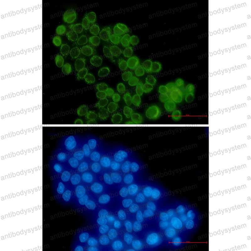 Anti-RANGAP1 Antibody (R1W73)