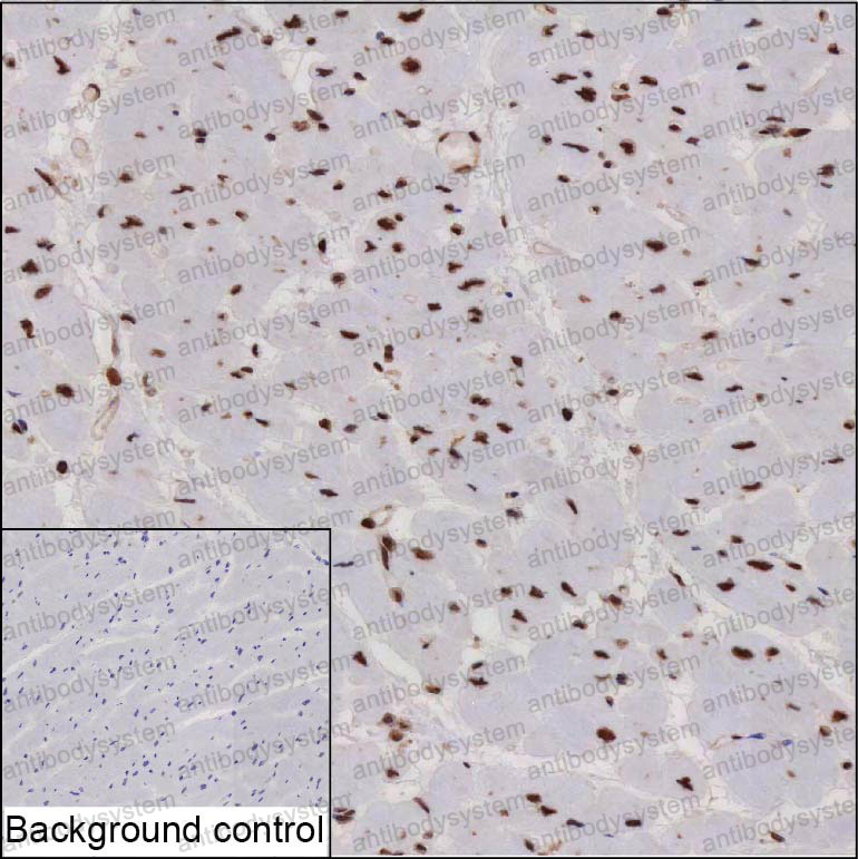 Anti-RECQL Antibody (R3L47)