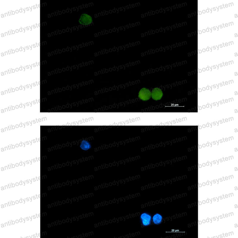 Anti-CRKL Antibody (R1W74)