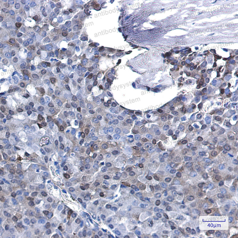 Anti-CDKN1B Antibody (R1W78)