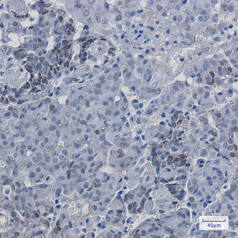 Anti-Phospho-CDKN1B (Ser10) Antibody (R1W77)
