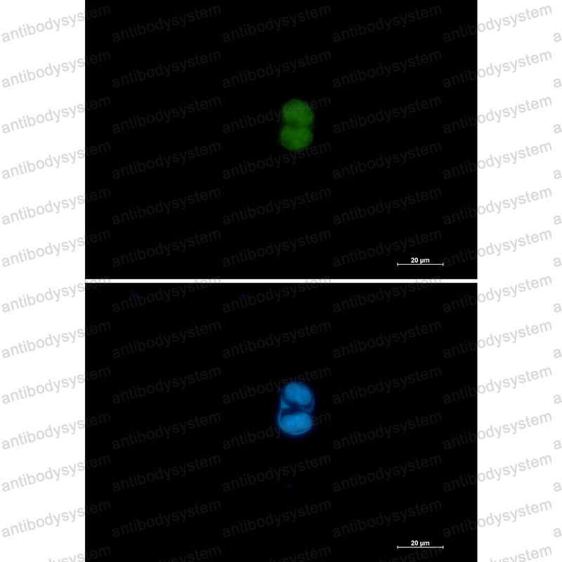 Anti-MEK3/MEK6 Antibody (R1W83)