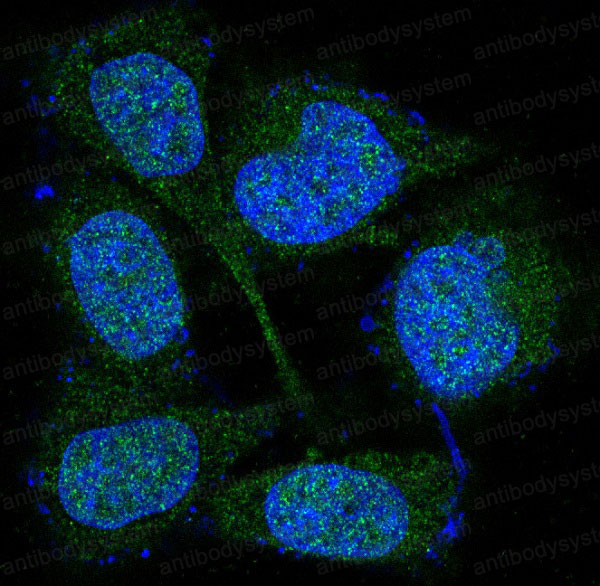 Anti-MEK3/MEK6 Antibody (R1W81)