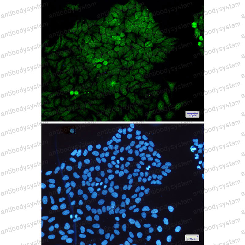 Anti-MAP2K3 Antibody (R1W82)