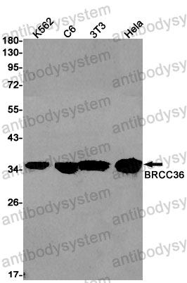 Anti-BRCC3 Antibody (R1W84)