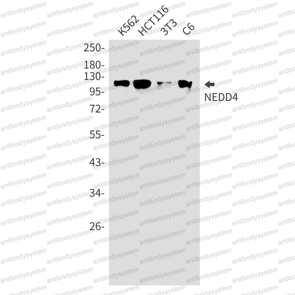 Anti-NEDD4 Antibody (R1W86)