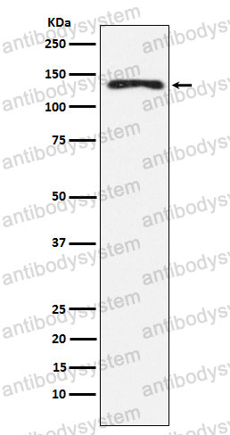 Anti-NEDD4 Antibody (R1W85)