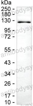 Anti-NEDD4 Antibody (R3L57)