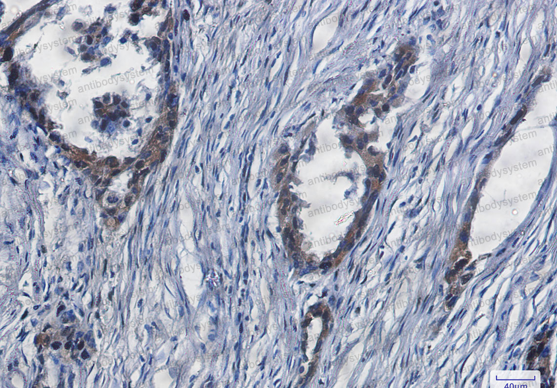 Anti-YAP1 Antibody (R1W89)