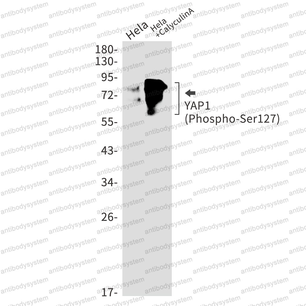 Anti-Phospho-YAP1 (Ser127) Antibody (R1W87)