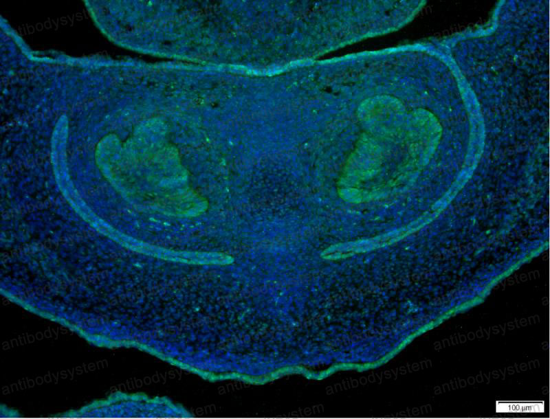 Anti-YAP1 Antibody (R1W88)
