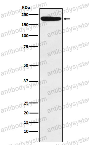 Anti-IQGAP1 Antibody (R1W90)