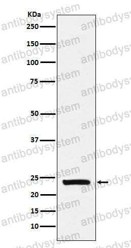 Anti-CSN1S1 Antibody (R1W91)