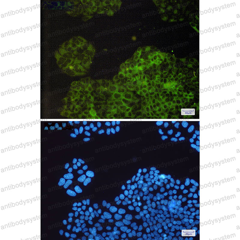 Anti-RAP1GAP Antibody (R1W93)