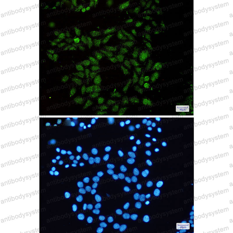 Anti-RAP1GAP Antibody (R1W92)