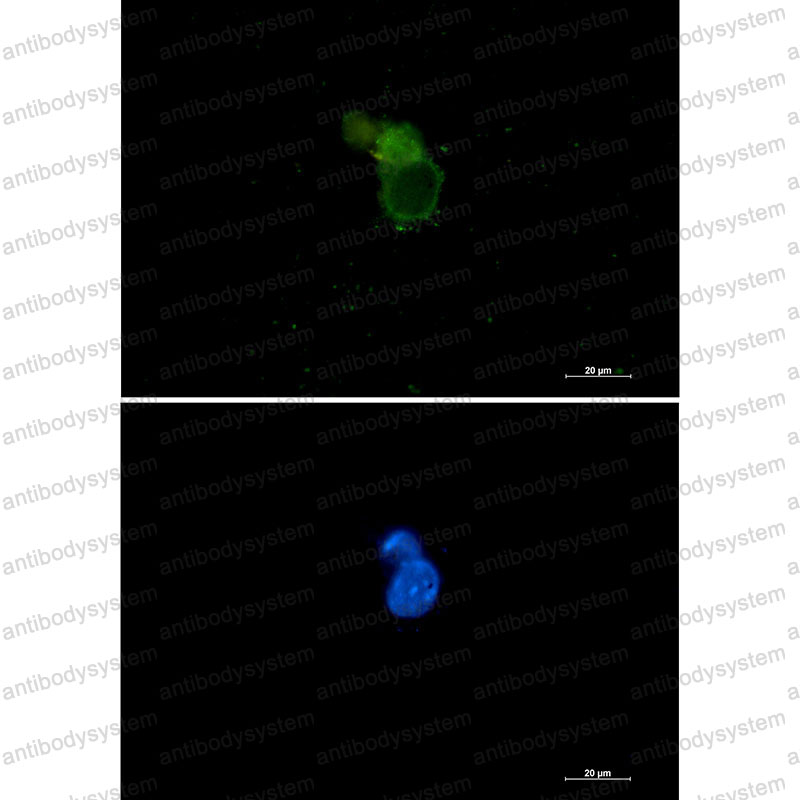 Anti-EIF1AX Antibody (R1W96)