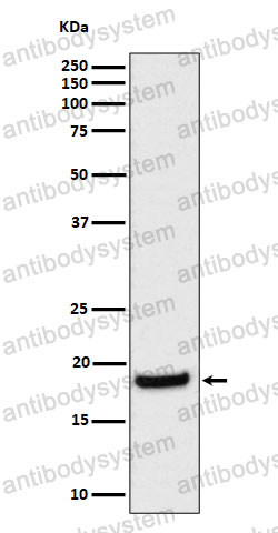 Anti-EIF1AX Antibody (R1W94)