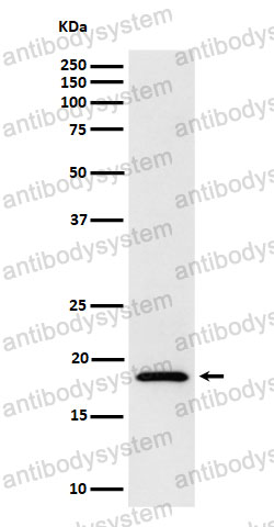 Anti-EIF1AX Antibody (R1W95)