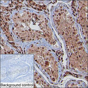 Anti-ID4 Antibody (R3L63)