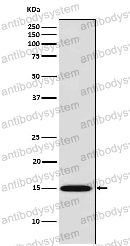 Anti-LGALS7/Galectin-7 Antibody (R1W99)