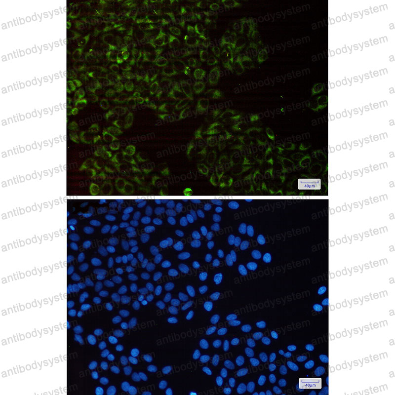 Anti-UQCRFS1 Antibody (R1X01)