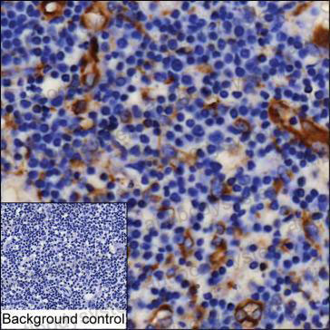 Anti-XCL1/Lymphotactin Antibody (R3L67)