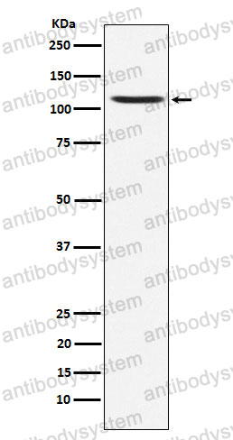 Anti-GRIA4 Antibody (R1X04)