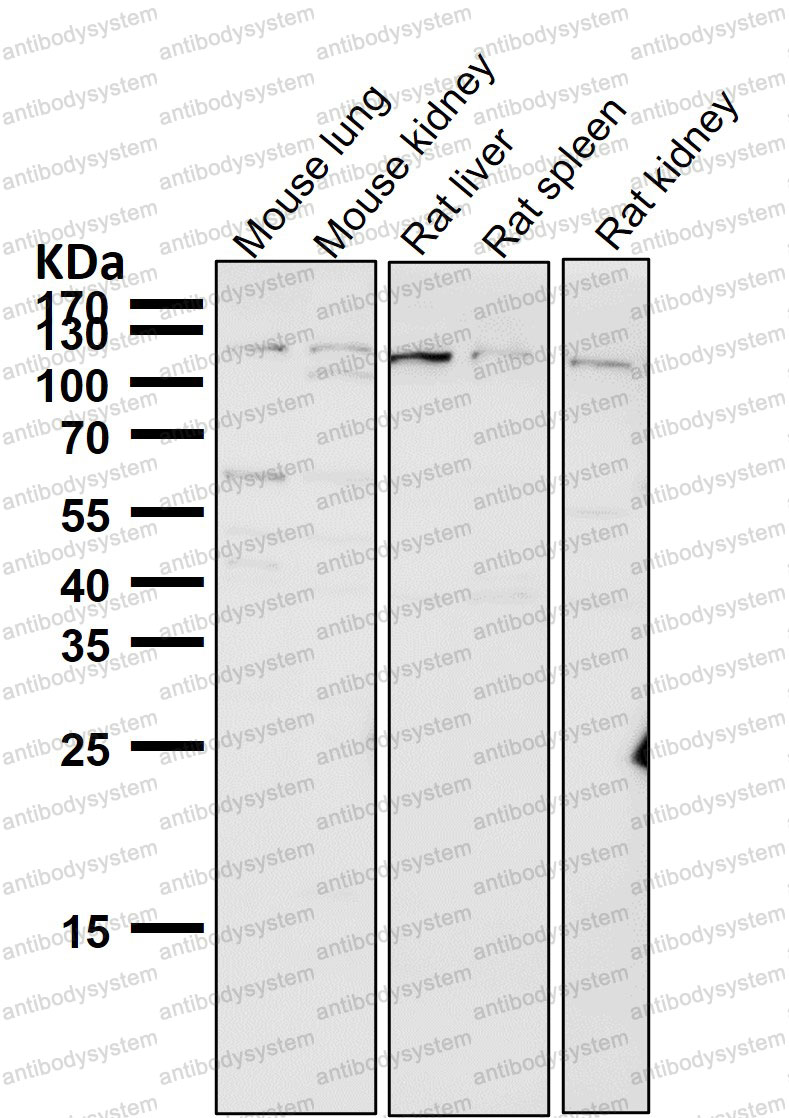 Anti-CD295/LEPR Antibody (R1X06)