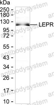 Anti-CD295/LEPR Antibody (R3L72)