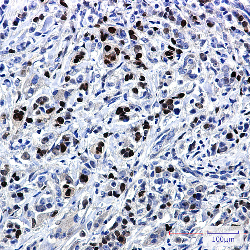 Anti-SOX9 Antibody (R1X08)