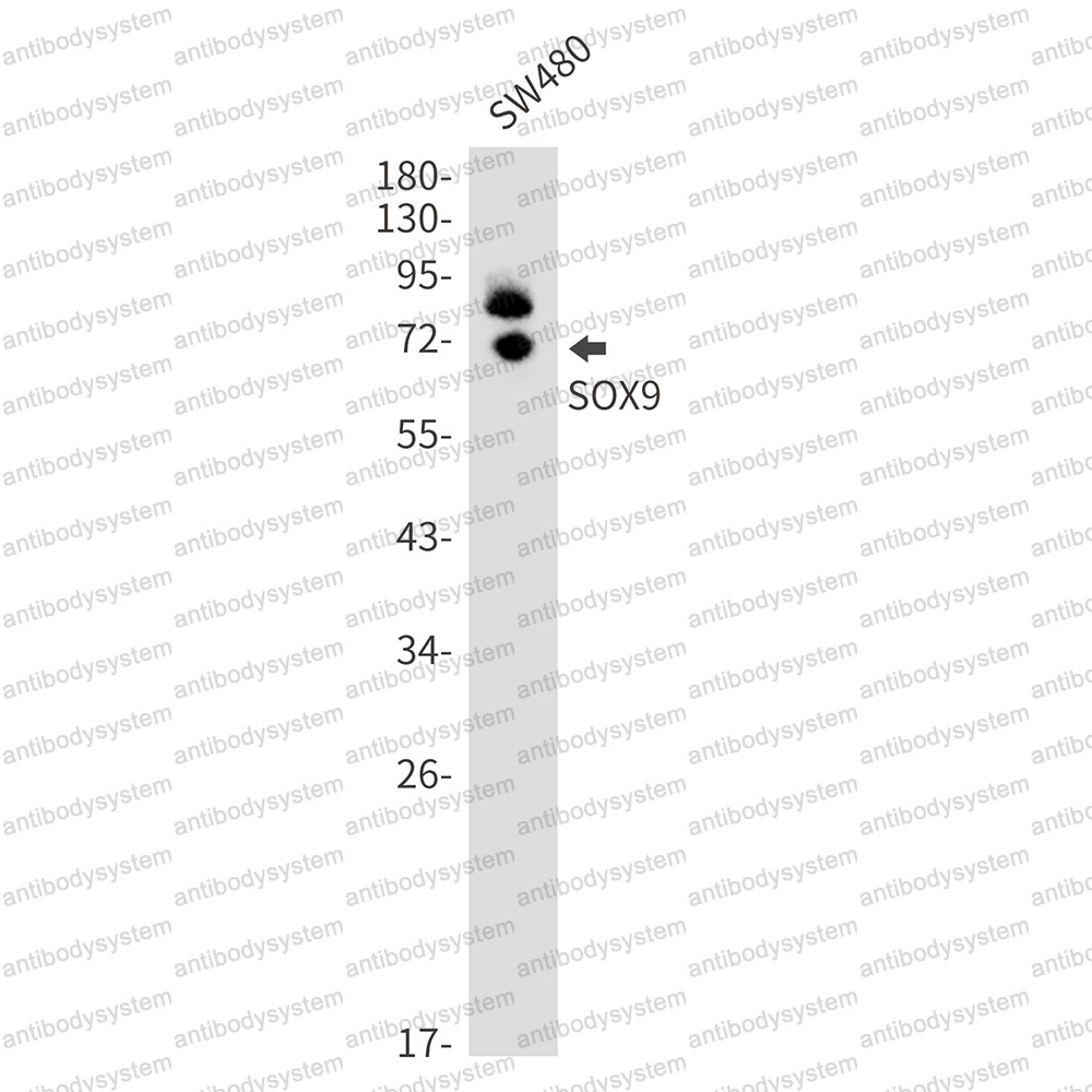 Anti-SOX9 Antibody (R1X07)