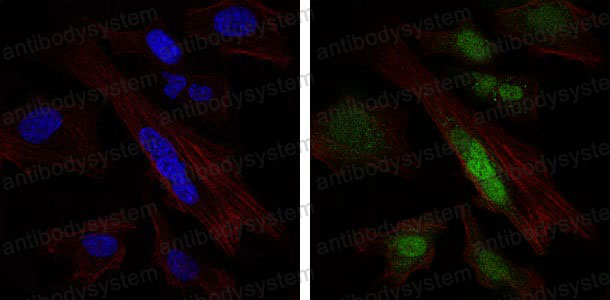 Anti-SOX9 Antibody (R3L74)