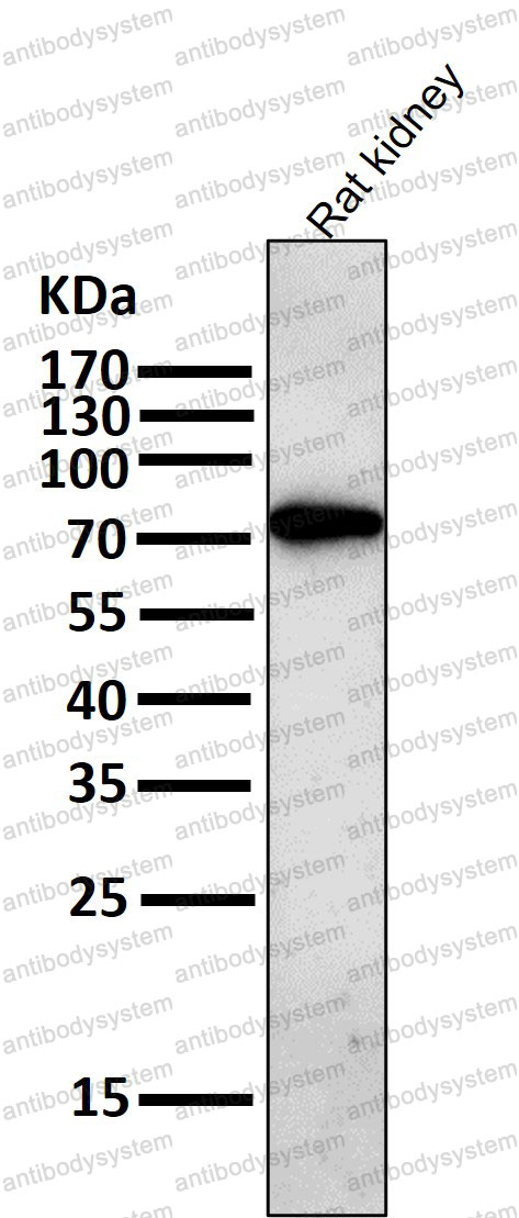 Anti-GCLC Antibody (R1X09)