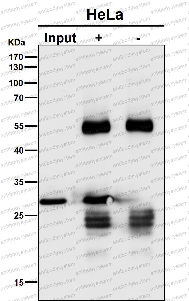Anti-GCLM Antibody (R1A70)