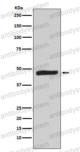 Western blot for Anti-MAPKAPK2 Antibody (R1X26) ?>