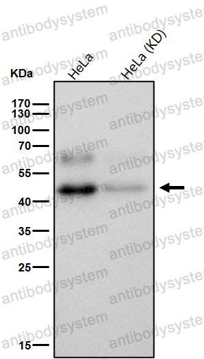 Western blot for Anti-MAPKAPK2 Antibody (R1X26) ?>