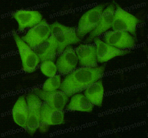 Anti-FASN Antibody (R3L87)