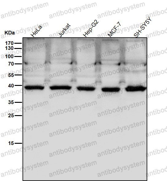 Western blot for Anti-PCYT1A Antibody (R1X43) ?>