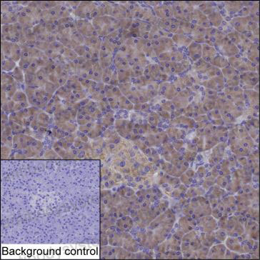 Anti-CARS1 Antibody (R3L88)