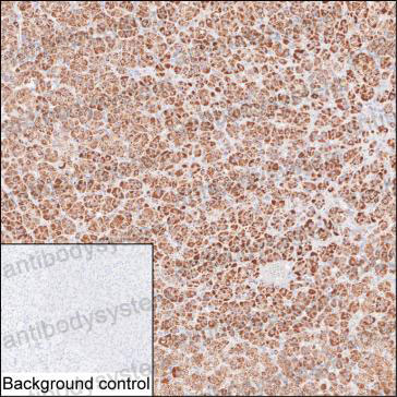 Anti-STAR Antibody (R3L89)
