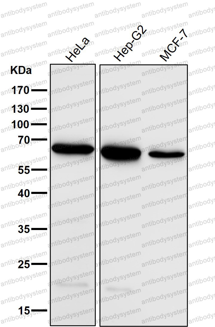 Western blot for Anti-ACADVL/VLCAD Antibody (R1X60) ?>