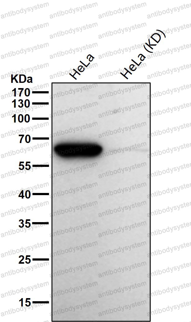 Western blot for Anti-ACADVL/VLCAD Antibody (R1X60) ?>